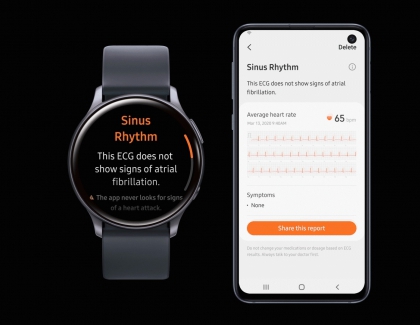 Electrocardiogram Monitoring Cleared for Galaxy Watch Active2 by South Korea