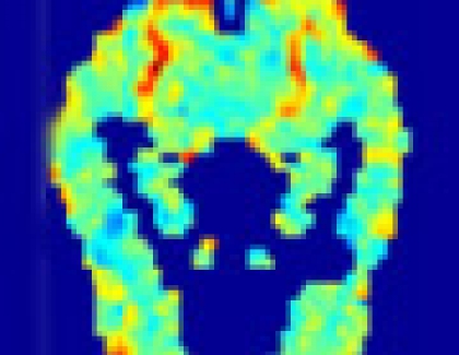 Computer Reveals How Brain Represents Meaning