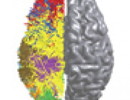 IBM Moves Closer To Creating Computer Based on Insights From The Brain